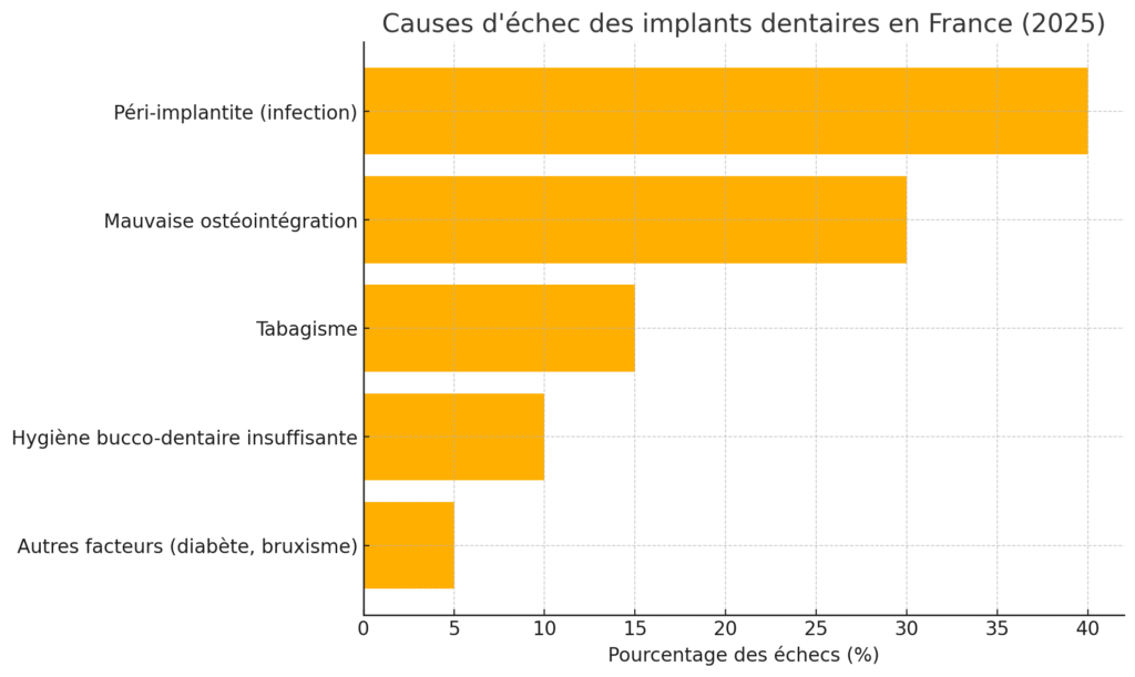 Causes D'échec Des Implants Dentaires En France