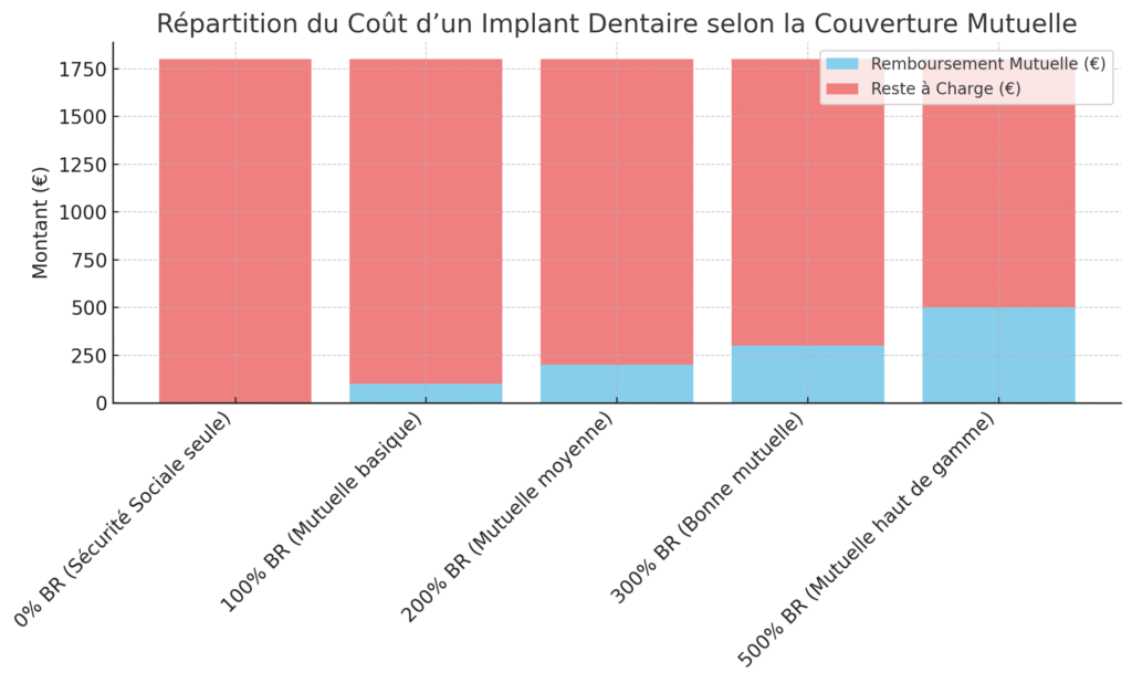 Coût Implant vs Remboursement Mutuelle