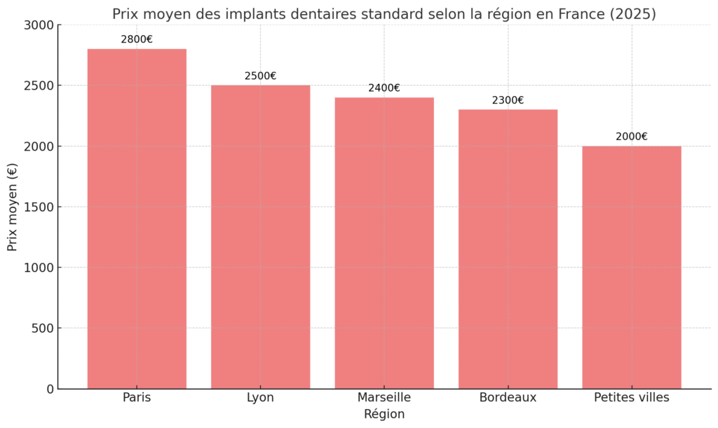 Prix implants par région (2025)