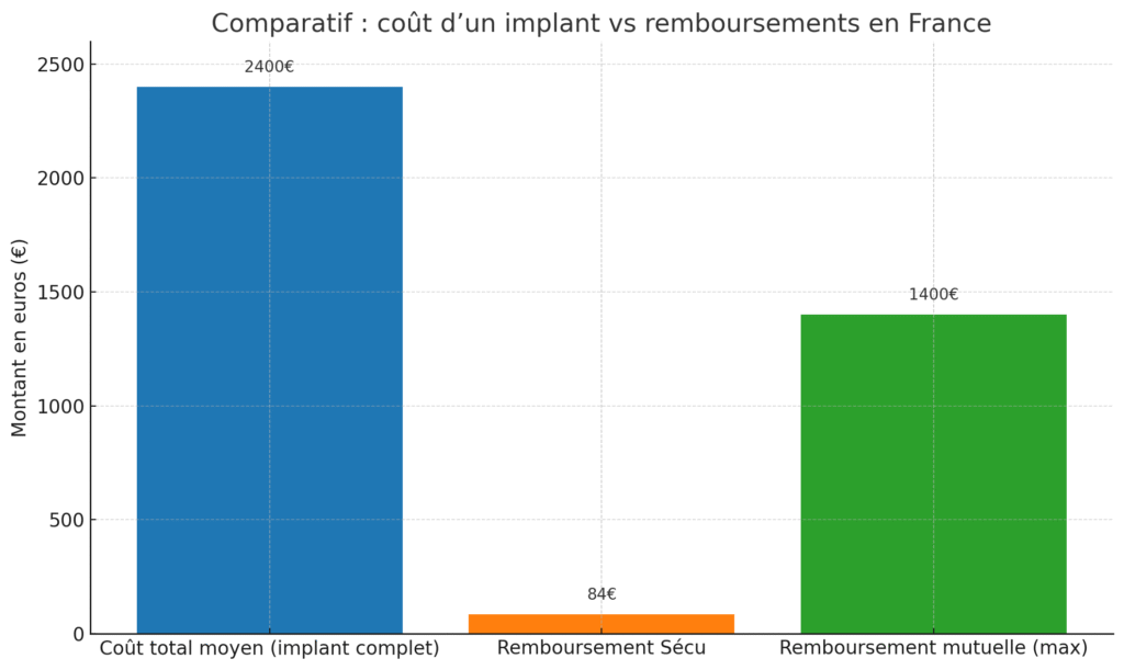Coût d’un implant vs remboursements en France
