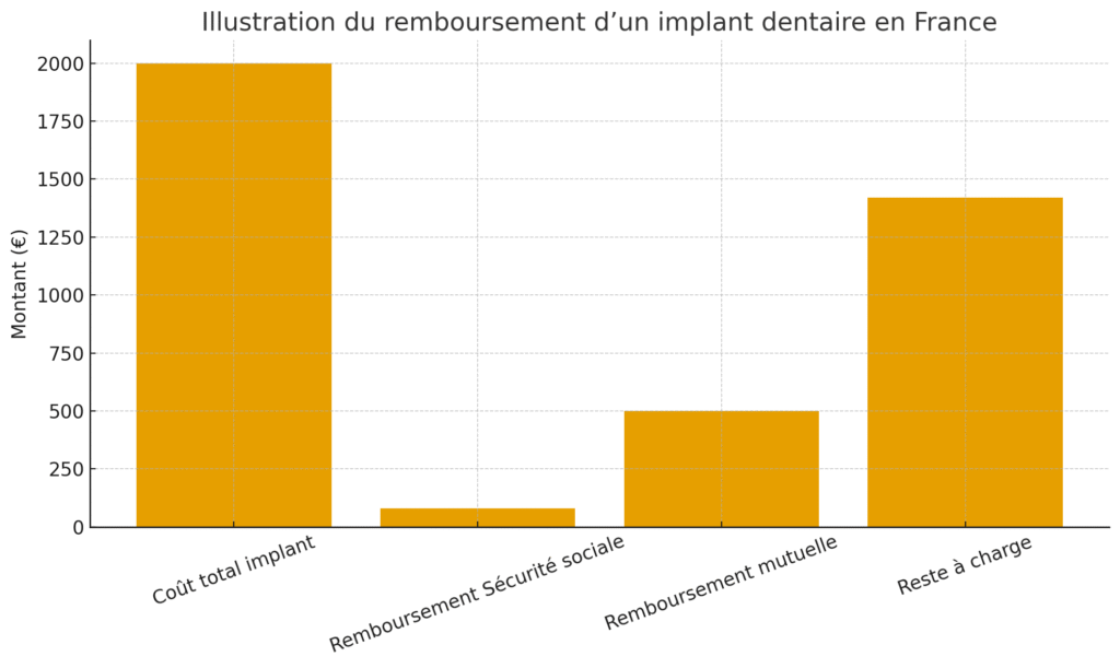 Ce que couvre généralement l'assurance