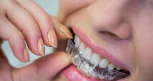 Open Graph Universal